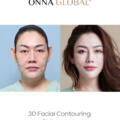 Summer Makeover in Korea: Top 3 Cosmetic Surgeries Loved by International Clients